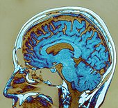 brain.jpg
